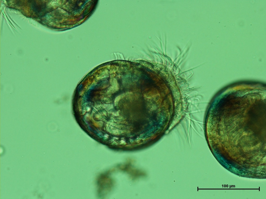 Oyster larvae as seen through a microscope.